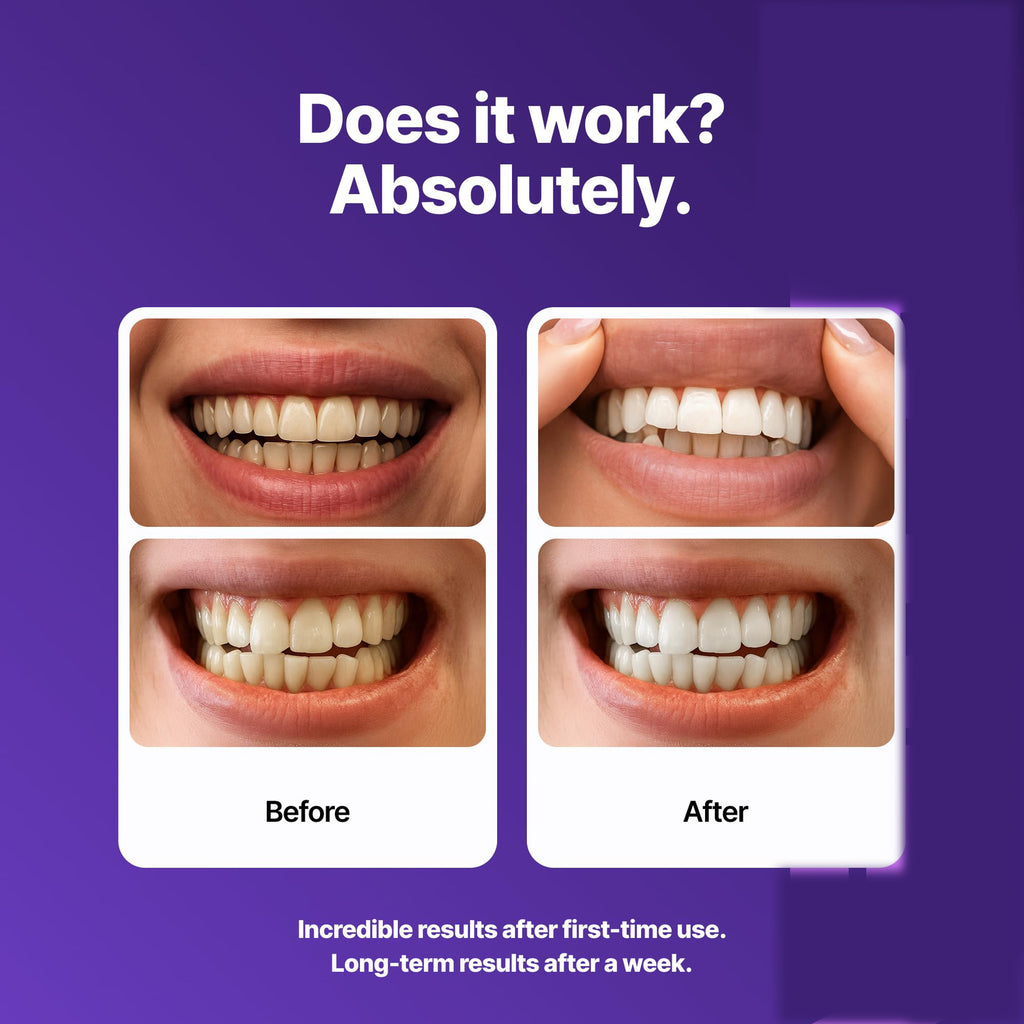 Purple Teeth Whitening Strips with Enamel Protection